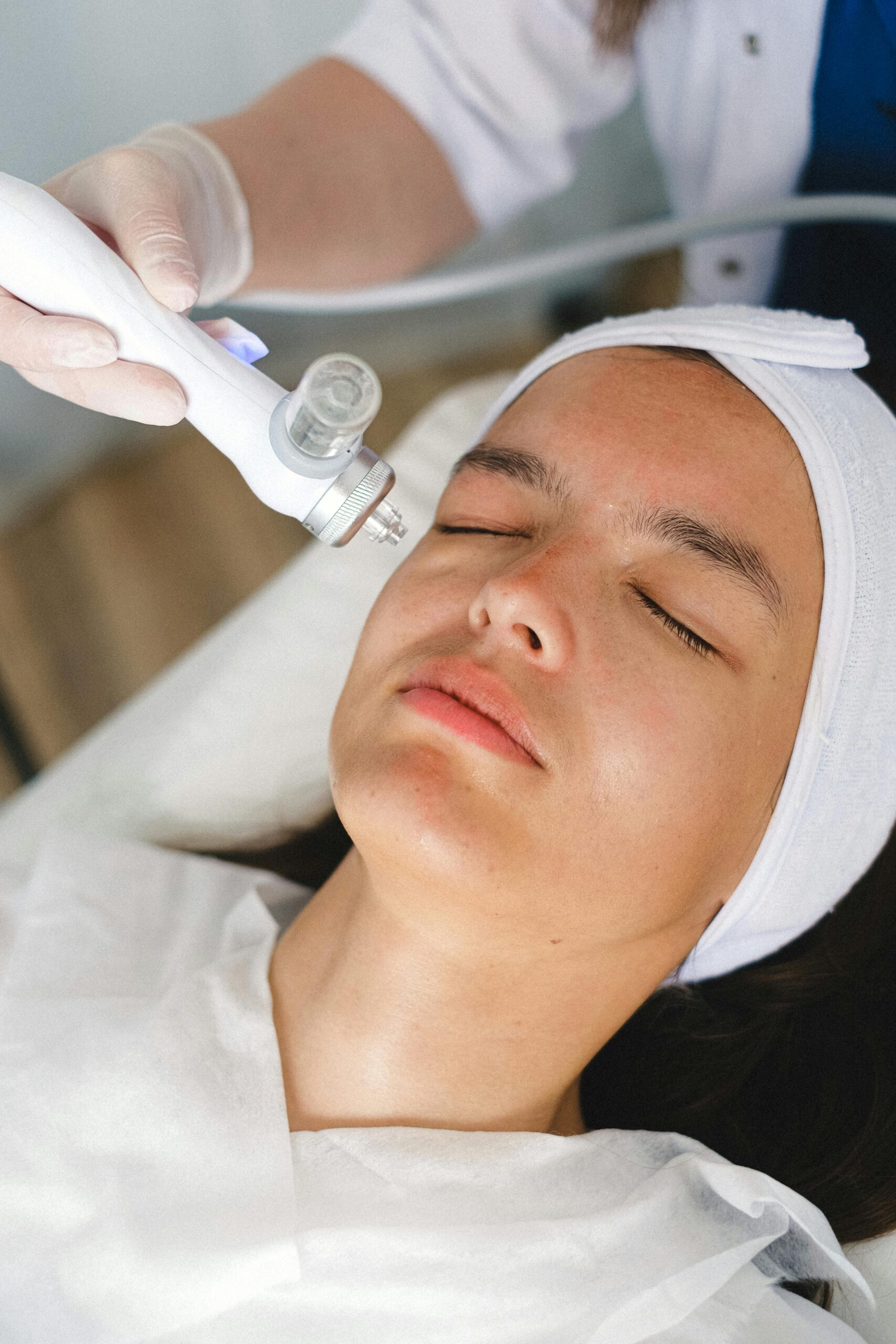 IPL and laser treatment – Eyes That Pop, All Day Long